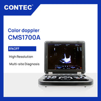 Portable Color Doppler CONTEC CMS1700A CMS1700B CMS1700C Ultrasound Machine with Convex Probe